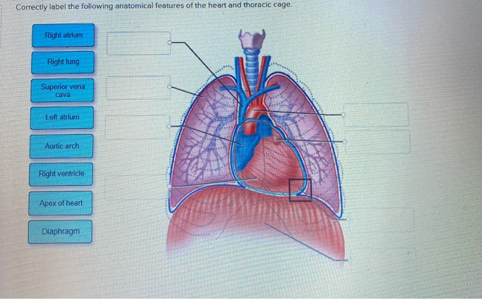 Label anatomical correctly following lymph node features lymphatic sinus cortical chegg cortex vessel ebook transcribed text show nodule medulla subcapsular